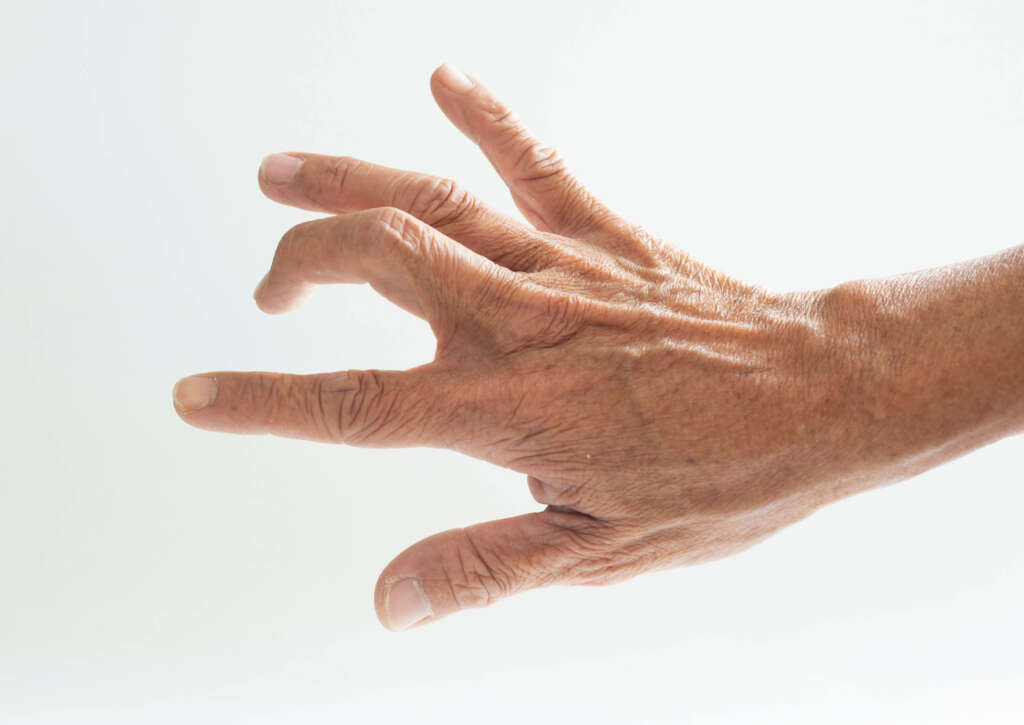 Trigger Finger Release Plastic Reconstructive Surgery