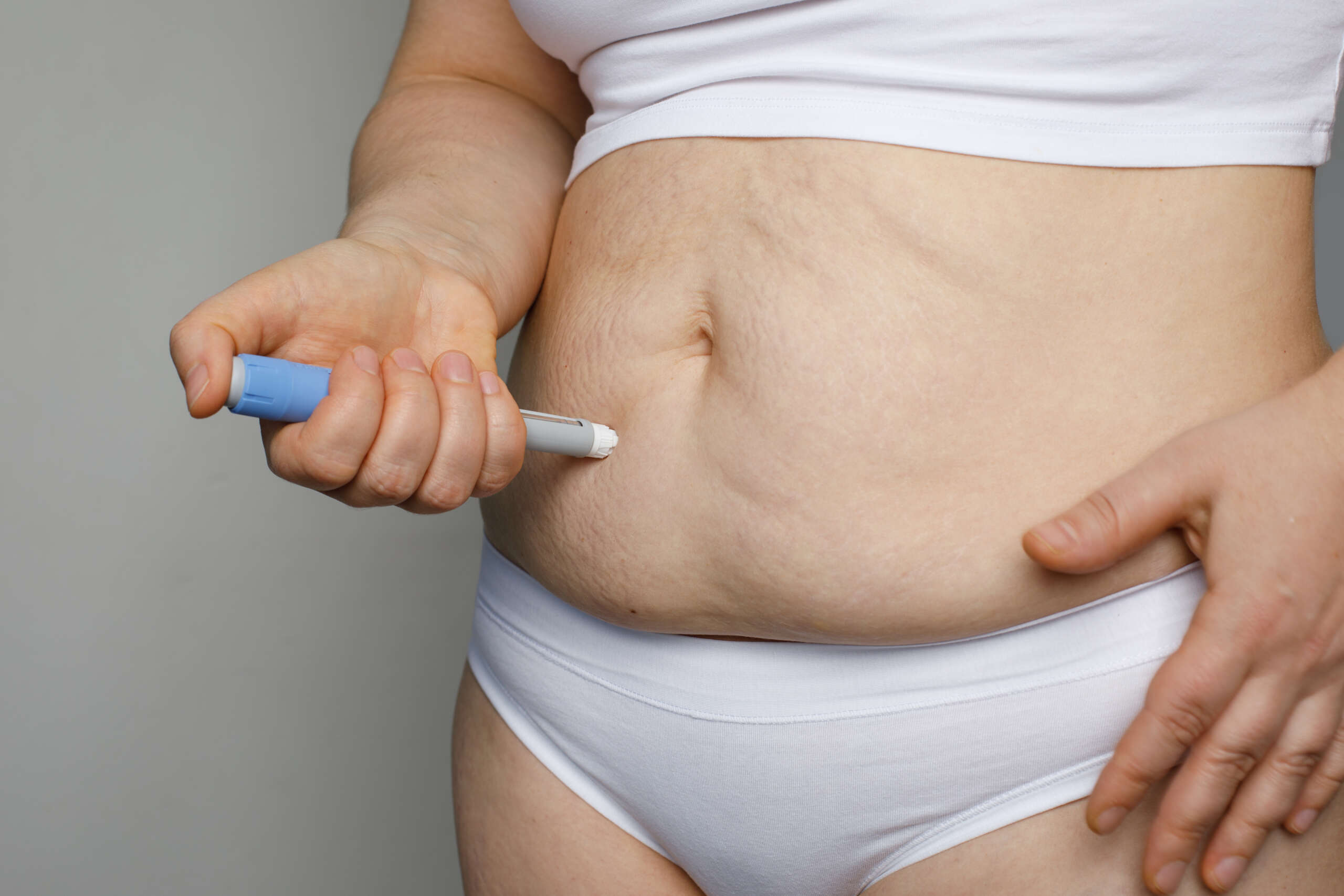 Body Contouring After Ozempic or Surgery: Timing Guide